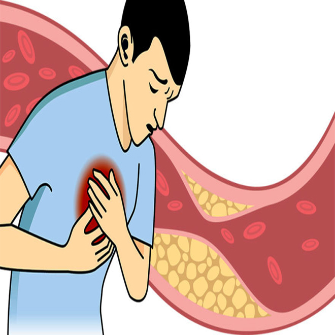 Cholesterol