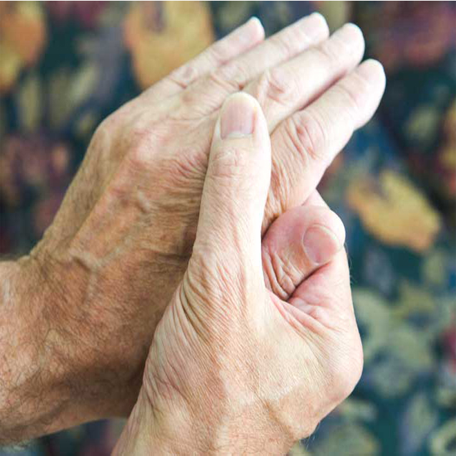 Rheumatoid arthritis